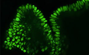 Microscopic image of fluorescently-stained organoids