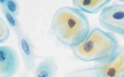 Cytology &amp; Cytodiagnosis