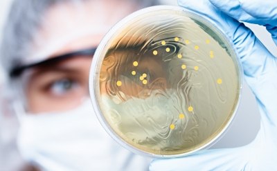 Scientist observing petri dish with bacterial colonies Scientist observing petri dish with bacterial colonies