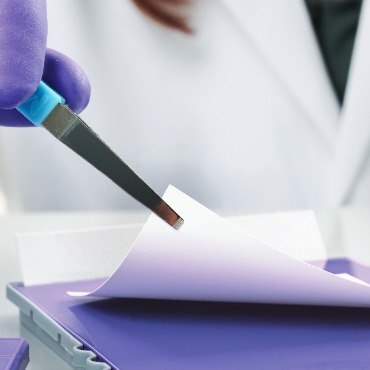 Transferencia de proteínas a membrana de PVDF para detección utilizando técnicas de inmunoelectrotransferencia.