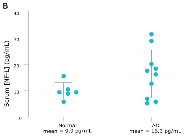 AD（n=10）のNF-L血清濃度は、正常（n=6）サンプルのほぼ2倍を示した。