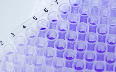 Close-up photograph of multi-pipettes adding samples to the deep well tray of a metabolite library kit with a violet solution in a laboratory.