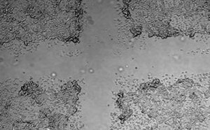 Cell Migration & Invasion Assays
