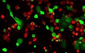 Live/dead cell double staining