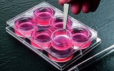 Cell Culture Inserts Cell culture cups