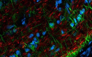 Antibodies