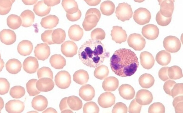 Hematology Stains Hematology Stains