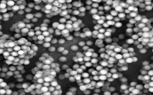 LC carbon particles 0