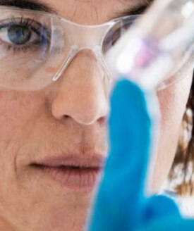 Lab worker examining cell culture media Lab worker examining cell culture media