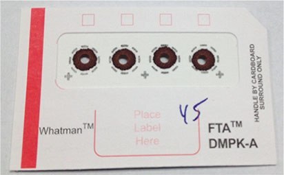 DBS Card after Blood Sample Addition and 3 mm Spot Punch-out DBS Card after Blood Sample Addition and 3 mm Spot Punch-out