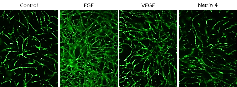 10,000 GFP labeled endothelial cells (HUVECs) were seeded in TrueGel3D<sup>®</sup> HTS Hydrogels with Human MSCs supporting cells (not fluorescently labelled) in 200 µL growth medium (70% <a href="/product/sigma/m4526">MEM-alpha</a>, 20% EGM-2, 10% FBS, 1% <a href="/product/sigma/p4333">Pen/Strep</a> and 10 ng/mL <a href="/product/sigma/f0291">FGF</a>). <a href="/product/sigma/f0291">FGF</a>, <a href="/product/sigma/v7259">VEGF</a> or Netrin-4 was added to media on the following day to evaluate their angiogenic potential. Angiogenesis was analyzed at day 10 by imaging and quantifying endothelial cell tubule length. FGF and VEGF increased angiogenesis while Netrin-4 inhibited angiogenesis. Application of TrueGel® HTS hydrogels in angiogenesis assays