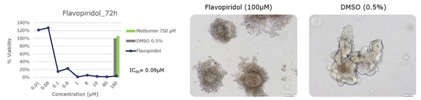 Cytotoxicity testing of flavopiridol using human colon organoids Microscopy images of human colon organoids testing cytotoxicity of flavopiridol. IC50 of flavopiridol in human colon organoids.