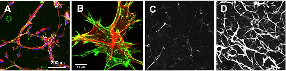 10,000 RFP labeled fibroblasts were seeded in the TrueGel3D<sup>®</sup> HTS Hydrogel in 200 µL of invasion medium (<a href="/product/sigma/m4526">MEM-alpha</a>, 10% FBS, 1% <a href="/product/sigma/p4333">Pen/Strep</a> and 10 ng/mL <a href="/product/sigma/p3201">PDGF</a>). The following day compounds to steer the ECM were added to the culture media. (A, B) Confocal micrographs of fibroblasts (red) and endogenous fibronectin (green). (C, D) Confocal micrographs of collagen deposited by fibroblast culture for 14 days without (C) or with (D) 50 g/L ascorbic acid. TrueGel® HTS hydrogels and collagen deposition using seeded fibroblasts