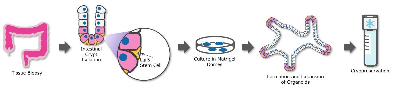 Patient derived organoids (PDOs) Isolation and cryopreservation of patient-derived organoids (PDOs) can be used to generate organoid biobanks.