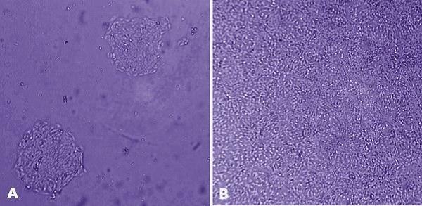 HaCaT cells (derived from human adult skin keratinocytes) were grown for 24 hours after plating on tissue culture plastic (<strong>A</strong>) and on 1% (w/v) human MaxGel<sup>™</sup> (<strong>B</strong>), which demonstrates that HaCaT cells proliferate better on MaxGel<sup>™</sup>. MaxGel™ ECM enables improved expansion of adult keratinocytes.
