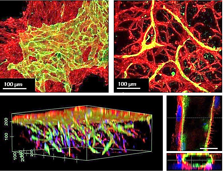 Human MSCs (red) and HUVECs (green) were co-cultured in conventional hydrogels (left) or TrueGel3D<sup>®</sup> HTS Hydrogels (right/bottom) for 7 days. The cells on the conventional hydrogel remained on the surfaces and segregated, whereas the cells deposited in TrueGel3D<sup>®</sup> HTS hydrogel invaded the gel and self-organized in cord-like vascularized 3D structures. TrueGel® HTS hydrogels in co-culture applications