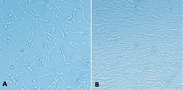 MRC-5 human fetal lung fibroblasts (05072101) were grown for 24 hours after plating on tissue culture plastic (<strong>A</strong>) and on 1% (w/v) MaxGel<sup>™</sup> ECM (<strong>B</strong>). As seen with other cells, MRC-5 cells propagate better on MaxGel<sup>™</sup> ECM. MaxGel™ ECM enables improved expansion of MRC-5 cells.