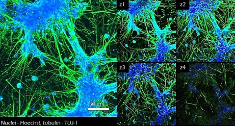 25,000 <a href="https://www.emdmillipore.com/US/en/product/Human-iPSC-Derived-Neural-Progenitors,MM_NF-SCC035" target="_blank">iPSC derived neural stem cells</a> were cultured in TrueGel3D<sup>®</sup> HTS Hydrogels and allowed to differentiate over 7-15 days. Differentiated cells show neural phenotypes with increased TUJ-1 expression (green) and complex neural networks. Calcium imaging (GCaMP6) was also performed at day 17 (data not shown) displaying active functional calcium spiking. Subsequently, glia cells can also be added to support the maturation of the cultures and study their interaction with neurons. Application of TrueGel® HTS hydrogels in culturing iPSC-derived neural stem cells