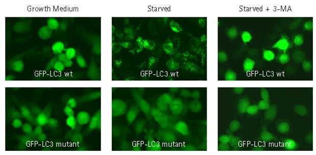 Autophagy inhibitor 3-MA prevents translocation of GFP-LC3