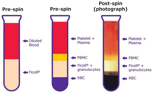 Diluted whole blood sample layering Diluted whole blood sample layering