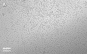 millicell-cell-lines-85011425-a