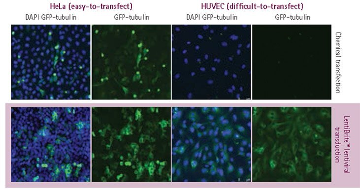 Plasmid vs. lentivirus transfection in easy- and difficult-to-transfect cell types.