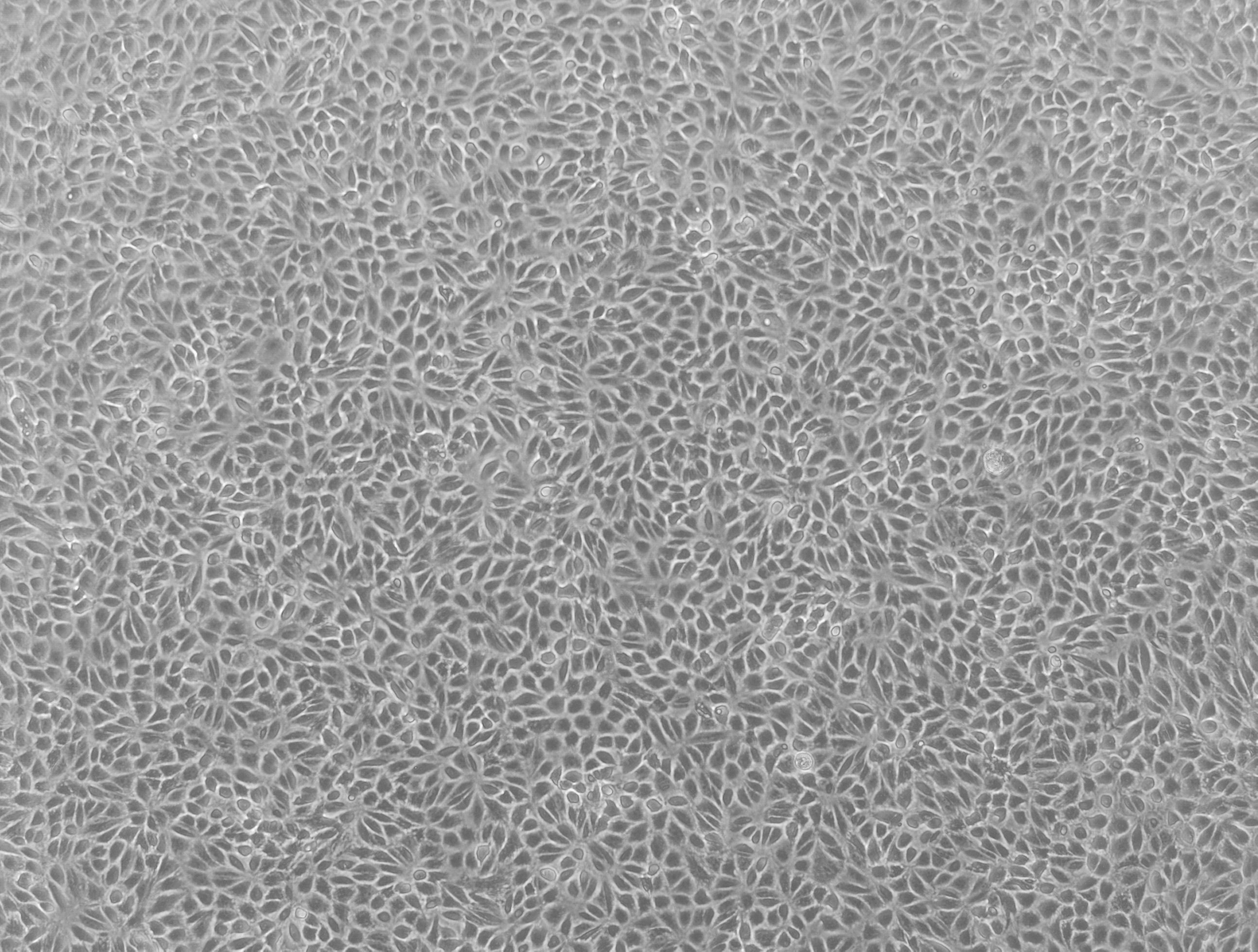 RPTEC SA7K cells plated in a 2D monolayer in cell culture. Human renal proximal tubule epithelial cells (RPTECs) are commonly used to predict human renal drug permeability and to investigate drug efflux. We have generated transporter knockout (KO) cell lines using CompoZr® Zinc Finger Nuclease (ZFN) technology in a proprietary renal proximal tubule epithelial cell line.