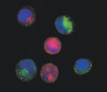 Coculture of Chemosensitive and Chemoresistant Labeled T24 Cells Coculture of Chemosensitive