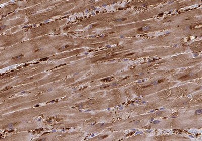 Immunohistochemical staining of cardiac muscle cell showing high expression of Fatty Acid Binding Protein 3 in human heart muscle using Anti-FABP3 polyclonal antibody Immunohistochemical staining of cardiac muscle cell