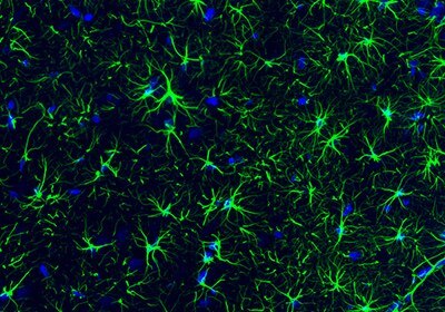 Neural Stem Cell Markers and Antibodies Immunofluorescence staining of rat hippocampus shows strong positivity of the astrocytes.