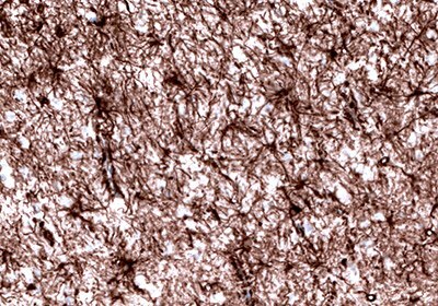 Neural Stem Cell Markers and Antibodies Immunohistochemical staining of the human cerebral cortex shows strong cytoplasmic positivity in astrocytes.