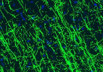 Neural Stem Cell Markers and Antibodies Immunofluorescence staining of rat hippocampus shows strong positivity of the astrocytes.