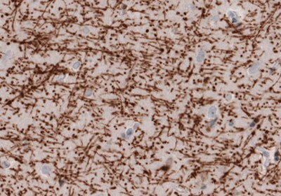 Neural Stem Cell Markers and Antibodies Immunohistochemical staining of the human cerebral cortex .