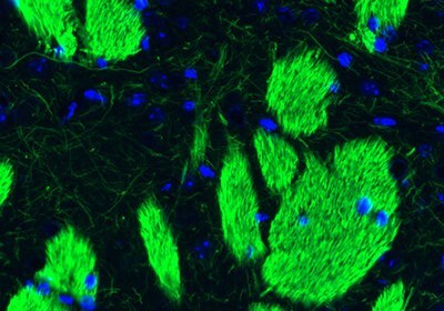 Neural Stem Cell Markers and Antibodies Immunofluorescence staining of mouse striatum.