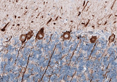 Neural Stem Cell Markers and Antibodies Human Cerebellum