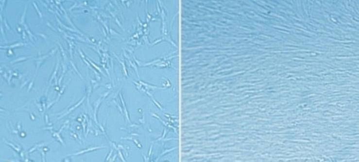 Extracellular matrix (ECM) coating enables rapid expansion of fetal lung fibroblasts. MRC-5 cells derived from human fetal lung fibroblasts were grown for 24 hours after plating on tissue culture plastic without (left) and coated with (right) <a href="/technical-documents/technical-article/cell-culture-and-cell-culture-analysis/3d-cell-culture/extracellular-matrix">extracellular matrix gel</a> to enhance attachment. ECM matrix coating enables rapid expansion of fetal lung fibroblasts