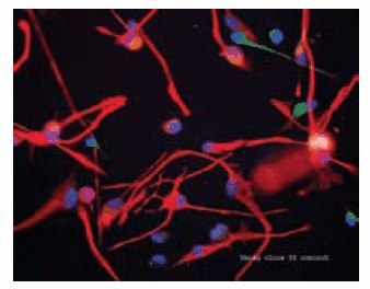 Immortalized cortical cell line in the presence of growth factors Immortalized cortical cell line in the presence of growth factors