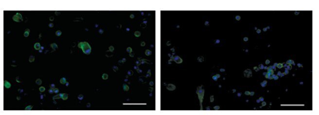 Demonstration of long-term culture and in-plate staining protocols using the CellASIC® ONIX Microfluidic platform ICC for CD9, a cell surface glycoprotein, on PC-3 cells following a fixation protocol