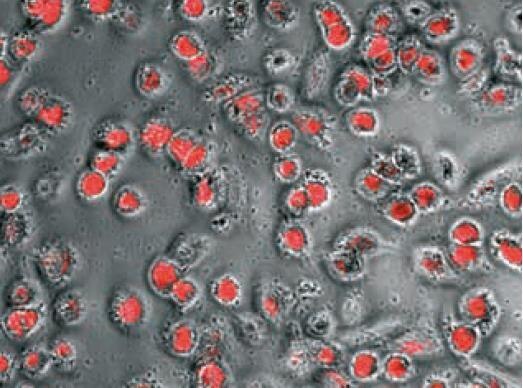 Human Macrophages Human Macrophages
