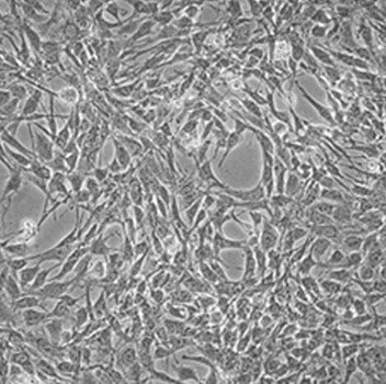 Stromal Cells for T-Cell Differentiation Stromal Cells for T-Cell Differentiation