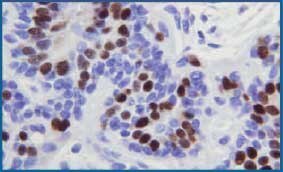 Microwave fixed breast tissue stained with IHC for estrogen receptor protein. Tissue shows minimal background staining. 400X