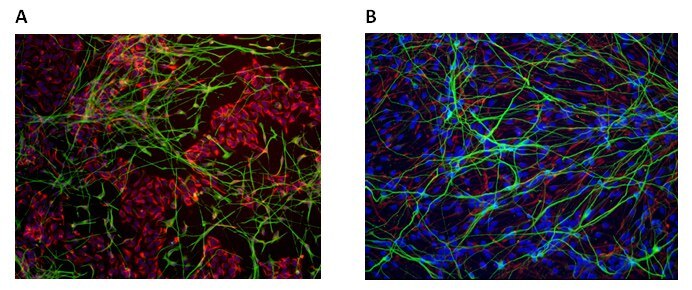 Neural Differentiation of Human iPS Cell Lines