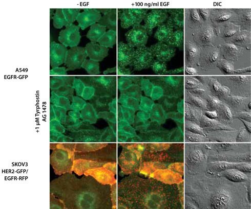 single-cell-clones-expressing-egfr-gene Isolated Single-Cell Clones Expressing the EGFR Gene
