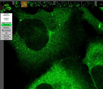 抗体による染色を示す抗CCNB1（サイクリンB1）免疫蛍光染色画像。