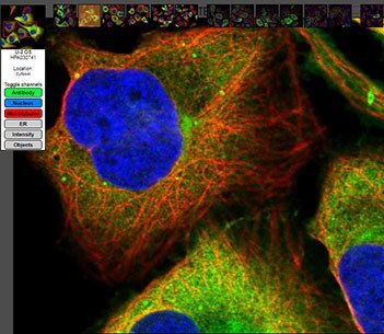 抗体による染色、核染色および微小管染色を示す抗CCNB1（サイクリンB1）IF画像。