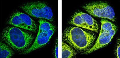 Anti-HSP90B1 (HPA003901) staining is shown in green, nuclear reference DAPI in blue and the endoplasmic reticulum (ER) reference marker detecting calreticulin shown in yellow. The yellow signal overlaps with the green antibody signal, confirming ER-specificity. Organelle Markers in Subcellular Localization Studies