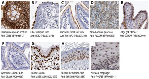 Immunohistochemical stainings showing subcellular localization using Prestige Antibodies®. Recognition of target antigen is represented by brown color. Immunohistochemical Stainings Showing Subcellular Localization