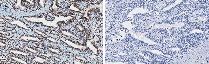 Enhanced Validation-Recombinant Antibody Technology Enhanced Validation-Recombinant Antibody Technology