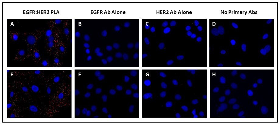 Detection of EGF-induced EGFR:HER2 dimerization using Duolink® PLA