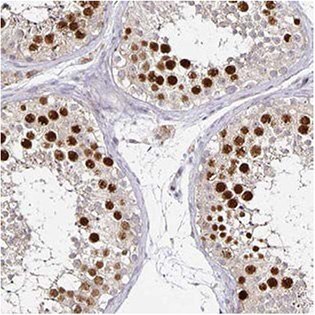 anillin-antibodies anillin-antibodies